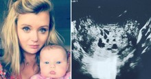 'Pregnant' Woman Is Heartbroken To Learn Her 'Baby' Is Actually A Tumor