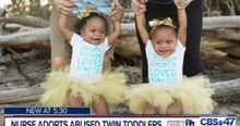 An Abused Toddler Was Admitted Into The Hospital When Her Live Changed Forever