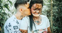 Woman with Incurable Skin Disease Trusted God To Send Her A Man Who Saw With His Heart