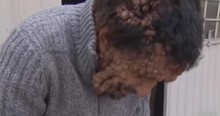 Man With Boils Is Shown Incredible Compassion