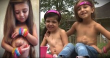 Jesus Gave This Little Girl A Special Heart, And Now A Special Friend Too