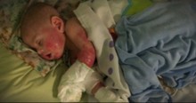 Mom Figures Out Why Her Baby's Skin Is 'Melting Off'