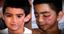 Young Boy’s Face Started Melting But He Knew God Had A Plan For Him