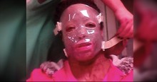 Woman Disfigured By Boyfriend In Fit Of Jealousy Uses Her Story To Inspire
