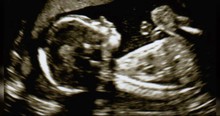 A Mother’s Letter To The Son She Was Never Supposed To Have -- POWERFUL!