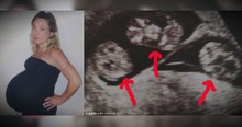 Mom Told To Abort 2 Of Her Babies Gets A Miracle