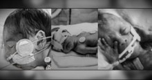 Seeing These Premature Babies Today Remind Us Miracles Do Exist