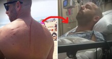 Shark Attack Turns Out To Be A Blessing When Doctors Find Tumor