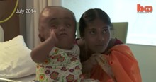 This 2-Year-Old's Parents Couldn't Afford Surgery. But Kind Strangers Stepped Up To Save Her Just In Time!