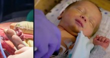 Unborn Baby Removed From Womb To Receive Life-Saving Surgery, Then Doctors Put Him Back