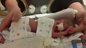 The Kennedy Britton Story, born at 23 weeks