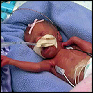 Dying Woman is Forced to Give Birth Early - Miracle Outcome