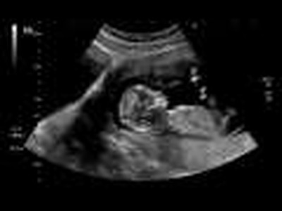 Pro-Choice?