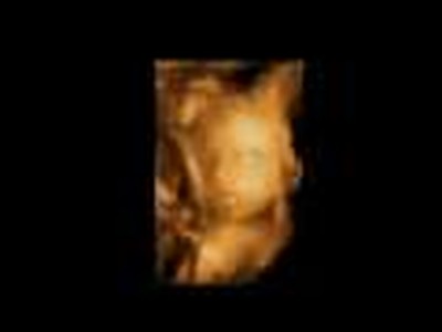 Baby smiling from the womb