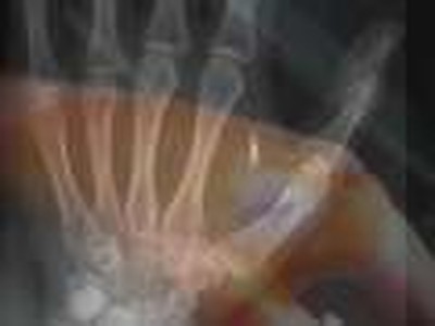 RFID Chips in Japanese