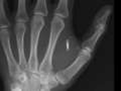RFID Chips in Dutch