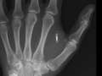 RFID Chips in Arabic