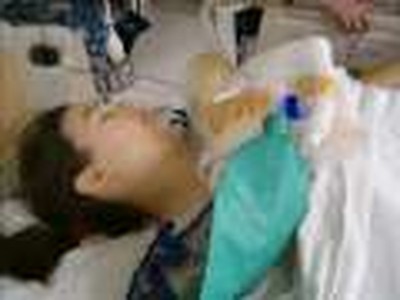 A Scoliosis Video(Praise You in This Storm by Casting Crowns