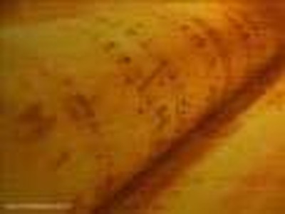 Instrument - Psalm 151
