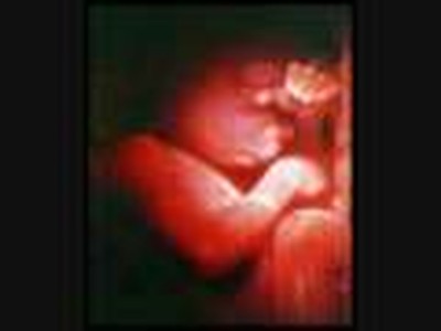 Pro-Life