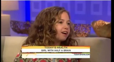 Little Girl Lives With Half Her Brain - Miraculous Story!