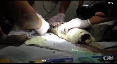 Baby Flushed Down Sewer Miraculously Survives - A Miracle of God! (Viewer Discretion Advised)