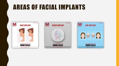 Facial Implants - Meddco