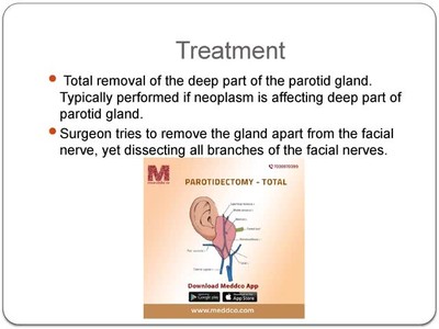 Parotidectomy Total - Meddco