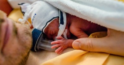 World's Smallest Baby Was Born - A True Miracle of God