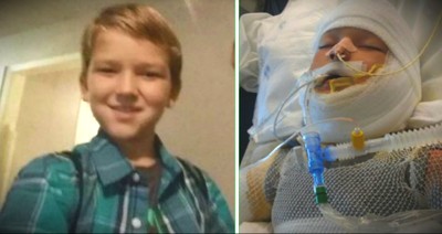 10-Year-Old With Special Needs Fights For Life After Being Set On Fire