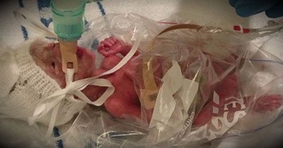 This Miracle Baby Is Alive Today After Being Placed In A Plastic Bag