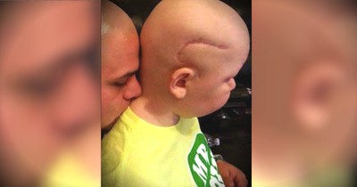 Scar From Surgery Makes Son Insecure, So Dad Gets Tattoo To Match