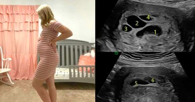 Mom's Sorrow Turns to Joy As She Gives Birth to Rainbow Baby with Help From Guardian Angels