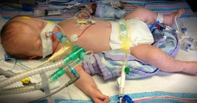 Parents Saying Goodbye As Baby Is Taken Off Life Support Get A Miracle