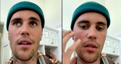 Justin Bieber Is Suffering From Partial Paralysis And He Asks Fans 'Please Pray For Me'