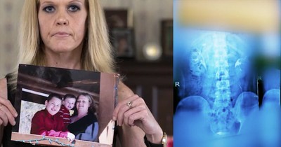 Regrets About Deadly Mexican Weight-Loss Surgeries