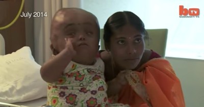 This 2-Year-Old's Parents Couldn't Afford Surgery. But Kind Strangers Stepped Up To Save Her Just In Time!