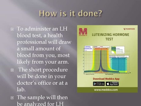 Luteinizing hormone Test - Meddco