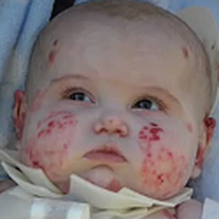 Baby with a Terrible Disease Needs Your Prayers