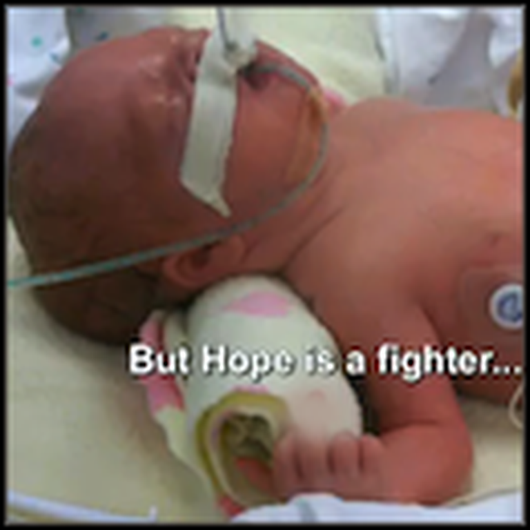 Doctors Said This Baby Would Never Walk - But Watch This