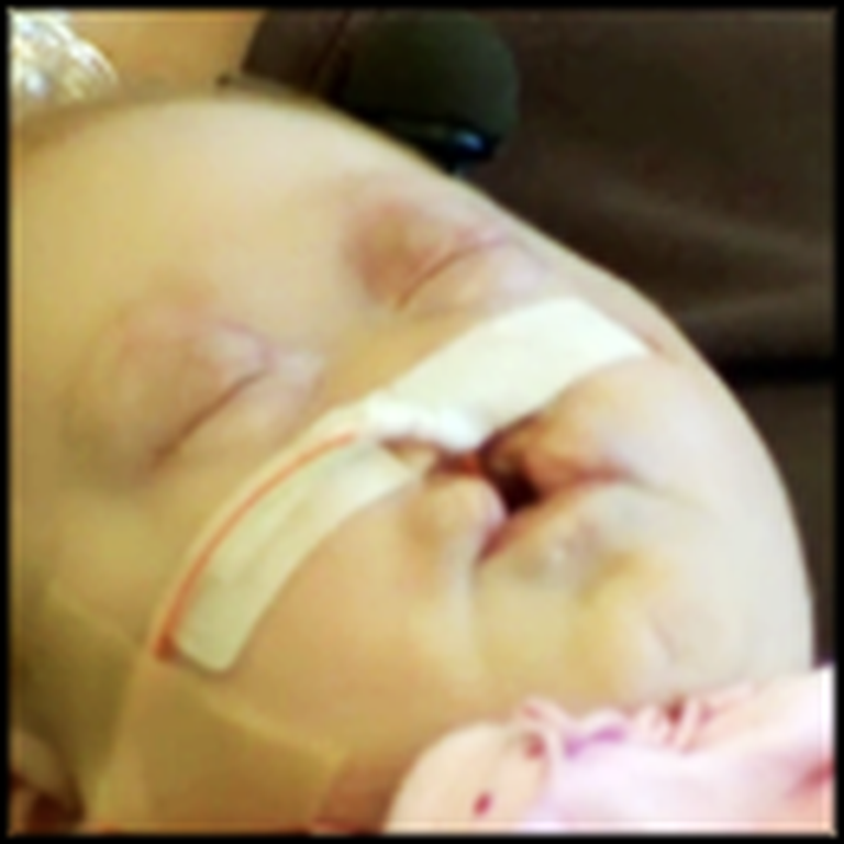 Doctors Said This Baby Should Not Live - But God Had a Plan for Pearl