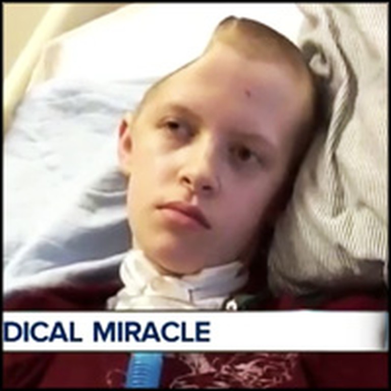 God Saved a Boy That Suffered a Massive Stroke and Lost Half of His Skull