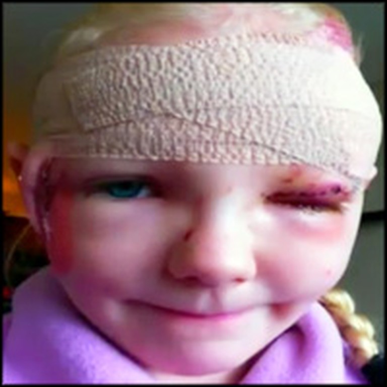 Little Girl Saved From Vicious Pit Bull Attack By a Chihuahua