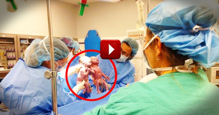 How These Rare Twins Entered The World Is AMAZING. I've Never Seen Anything Like THIS!