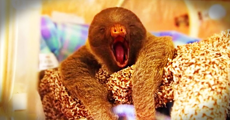 If You Think This Is Just A Cute Sleepy Baby, Then Wait 'Til You Hear His Incredible Story! WOW!