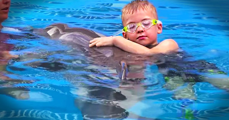 This Adorable Duo Just Melted My Heart. This Boy And Dolphin Have Something Special In Common!