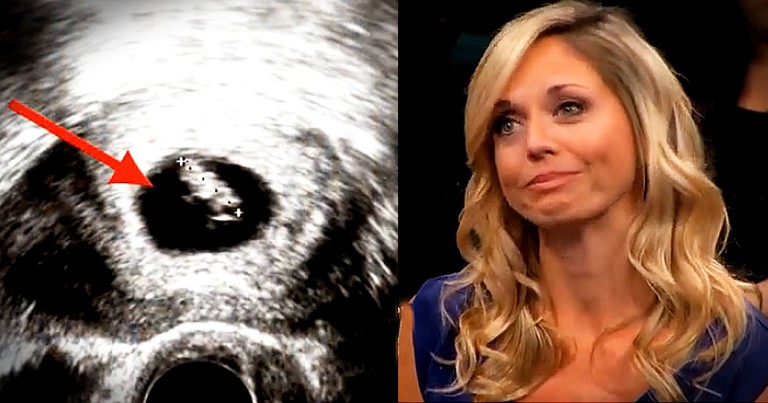 Doctor Says Mom-To-Be Miscarried But She Proves Them Wrong With Second Ultrasound