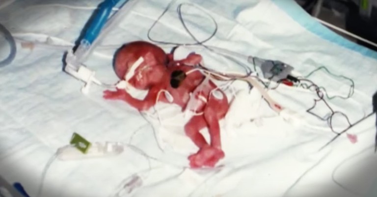 Family's Miracle Baby Stunned The World, Just Look Where They Are Now