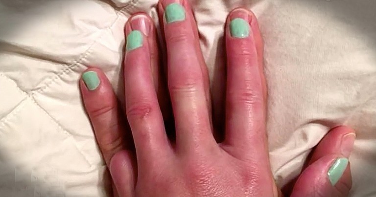 Husband Lets Wife Paint His Pinky Finger For Heartwarming Reason