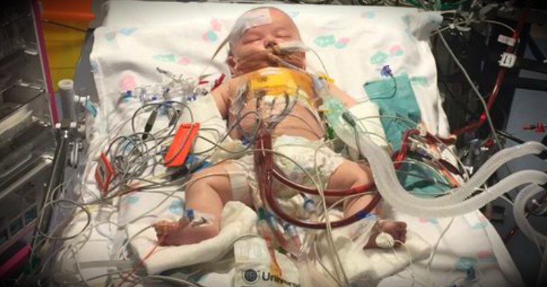 Miracle Baby Survives Surgery That Stopped His Heart For 15 Hours